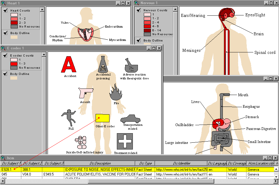 Different BodyViewer Systems and Sub-systems Close-up Maps are shown (there are many more), offering much more detail than the general All Systems Body Map (see screenshot above). Notice the database drill-down (red line); clicking 'Other-E codes' on BodyViewer's E codes Map selects the corresponding field(s) (in yellow) from HealthCyberMap's database (in this case Exposure to Noise - ICD: E928.1)